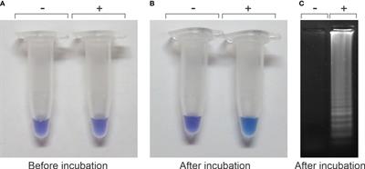 A colorimetric, sensitive, rapid, and simple diagnostic kit for the HLB putative causal agent detection